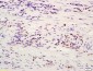 Rabbit Anti-ATF4/CREB-2 Polyclonal Antibody