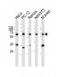 Pyruvate Kinase (PKM2) Antibody (C-term)