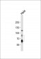 PCSK9 Antibody (N-term)