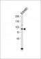 PCSK9 Antibody (N-term)