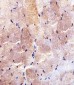 HK2 (Hexokinase II) Antibody (Center)