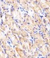HK2 (Hexokinase II) Antibody (Center)