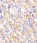 HK2 (Hexokinase II) Antibody (Center)