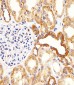 BCL2L11 Antibody (Center)