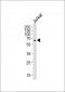 IL2RG Antibody (N-term)