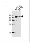 ALDH6A1 Antibody