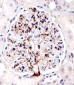 FABP4 Antibody