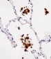 FABP4 Antibody