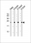 SOD2 Antibody