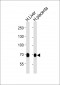 FLT1 Antibody