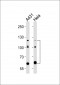 ABL2 Antibody