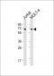 ZAP70 Antibody