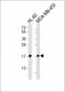 FHIT Antibody