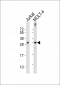 TCRB Antibody (Center)