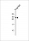 TCRB Antibody (Center)