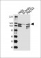 UBE3C Antibody (Center)