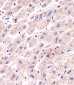 PPP2R2A Antibody (N-term)