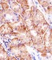 MATN2 Antibody (C-term)