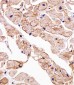 SGCG Antibody (Center)