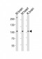 Mouse Ephb1 Antibody (Center)