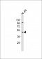 CHST12 Antibody (N-term)