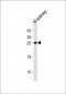 (Mouse) Cldn6 Antibody (C-term)