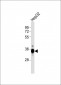 DKK1 Antibody