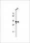 DKK1 Antibody