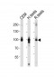 ACAP2 Antibody (C-term)