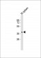 (Mouse) Tal1 Antibody (Center)