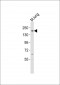 KDM6B Antibody (Center)