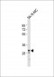 CBX7 Antibody (C-term)