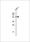 SSTR1 Antibody (C-term)