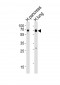 SSTR1 Antibody (C-term)