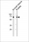 Mouse Nr5a2 Antibody (Center)