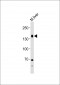 TSHR Antibody (Center)