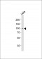 RPS6KA5 Antibody (C-term)