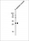 Mouse Hoxb1 Antibody (C-term)