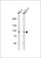 UHRF1 Antibody (N-term)