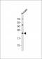 FAM168B Antibody (Center)