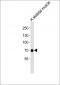 GABRQ Antibody (C-term)