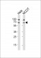 GNL3 Antibody (N-term)