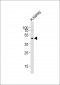 NPY2R Antibody (N-term)