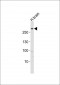 LRRK2 Antibody (C-term)