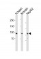 PROX1 Antibody (Center)