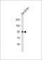 PROX1 Antibody (Center)