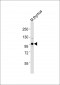 (Mouse) Uhrf1 Antibody (C-term)