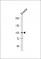 (Mouse) Med15 Antibody (C-term)