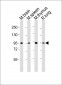 (Mouse) Med15 Antibody (C-term)