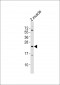 (DANRE) tmem208 Antibody (Center)